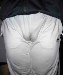 File:Frontal wedgie (cameltoe) of a male.jpg - Wikimedia Commons