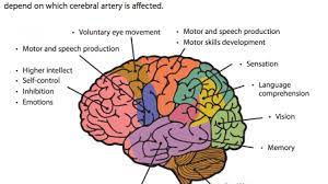 Findings in aca stroke may include the following: Identify The Vessel Recognize The Stroke American Nurse