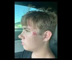 This is my friend's 17 year old nephew, Tanner. Yesterday he was enjoying a  day at Scissortail Park with his mother and younger siblings when he  noticed a person struggling in the