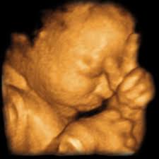 30 weeks is best for 3d/4d images of what your baby will look like after it is born. 4d Scan From Only 65 No 1 Uk Pregnancy Scan Provider Book Now
