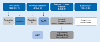 Endgame stan lee cameo explained. Multimodale Therapie Des Hepatozellularen Karzinoms Springerlink