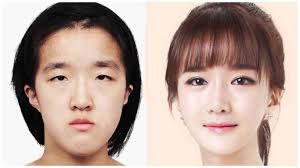 cosmetic surgery center 1 korean plastic surgery celebrity plastic surgery cosmetic surgery