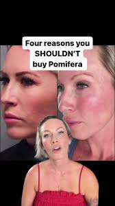 Pomifera Rose Vs Pure Mandy Simms