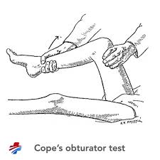 Image result for Obturator Sign