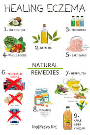 Eczema Eczema Treatment Eczema Remedies Remedies For Eczema Eczema Salve Natural Eczema Natural Eczema Treatment Eczema Remedies Diy Eczema Remedies