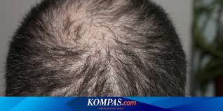 In fact, the answer may already be in your pantry. 8 Bad Habits That Make Your Hair Thin Fast Men Must Know Netral News