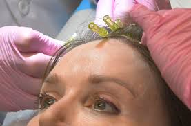 Threading doesn't actually cause more hair growth. Invigorating Procedure Makes Thinning Hair Grow Thicker