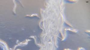 Microworm Culture Homemade Food For Guppy Fry Youtube