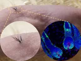 Stemson therapeutics secures $7.5m seed financing for the development of breakthrough hair regeneration therapy to cure hair loss. Baldness Breakthrough As Scientists Claim To Have Found Key To Growing New Hair From Stem Cells The Independent The Independent