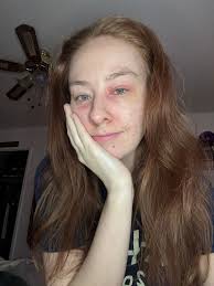 What safer medication/remedy can I use instead of this allergy medication?  I have severe inflammation