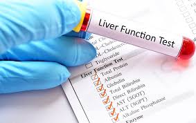 Image result for Liver Function Test Abnormality