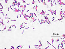 Bacillus Subtilis Wikipedia