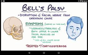 Bell's palsy affects about 40,000 people in the united states every year. Q44 Bell S Palsy Osmosis Flashcards Quizlet