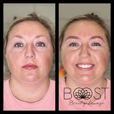 Heather Probst (@boost_esthetics) • Instagram photos and videos