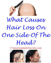 Hypothyroidism causes frontal hair loss and hyperthyroidism cause parietal hair loss. Pin On Hair Styles Tips