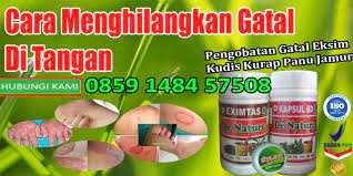 Secara ilmiah, gatal adalah sensasi yang timbul dari iritasi kulit atau sel saraf. Cara Menghilangkan Gatal Di Tangan