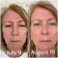 Riman Skincare Rewards Points Warning