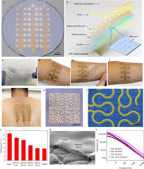 / upmc lemieux sports complex. Large Area Mri Compatible Epidermal Electronic Interfaces For Prosthetic Control And Cognitive Monitoring Nature Biomedical Engineering