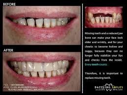 Malaysia, 58200, kuala lumpur, no.23, jalan kuchai maju 2, off jalan kuchai lama. Gallery Dazzling Smiles Dental Clinic