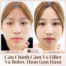 Thẩm Mỹ Doll Line