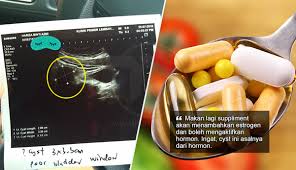 Dia terpilih untuk menjadi calon menjalani prosedur pembedahan perpindahan zakar. 3 Tahun Lepas Operate Buang Cyst Selepas Setahun Cyst Tumbuh Balik The Reporter