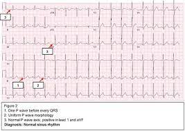 Heart murmurs can be present at birth (congenital) or develop later in life. Pediatric Cardiology