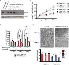 Check spelling or type a new query. Pten Disruption In Chordoma Is Associated With Enhanced In Vitro Download Scientific Diagram