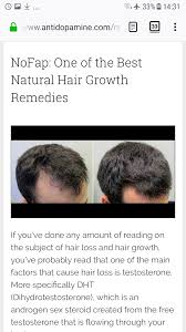 Since then fda has approved its use for hair growth. Pol Politically Incorrect Thread 197724222