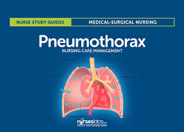 A collapsed lung occurs when air escapes from the lung. Pneumothorax Nursing Care And Management Study Guide Nurseslabs