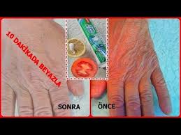 Dis Macunu Ile Limonu Cildinize Surun Olanlara Inanamayacaksiniz Super Sonuc Guzellik Cilt Bakimi Youtube