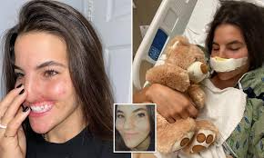 Model Brooklinn Khoury opens up about life changes after pit bull rips off  lip in horrific attack