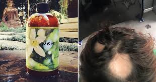 Wen hair care is a line of hair products which aim to clean and nourish your hair. Fda Launches Wen By Chaz Dean Hair Loss Investigation