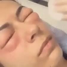 You've let it all out, and now it's time to pull yourself together. Puffy Eyes Gifs Tenor