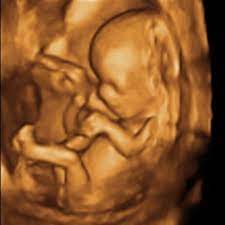 3d 4d Ultrasound Frauenarzt Stuttgart