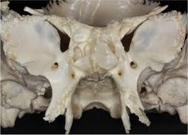 Ninja nerds,join us in this video where we show the sphenoid bone anatomy through the use of a model. Osseous Anatomy Of The Sphenoid Bone Neuroanatomy The Neurosurgical Atlas