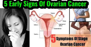 These changes are the result of the interaction between a person's genetic factors and three categories of. Signs Of Ovarian Cancer Health