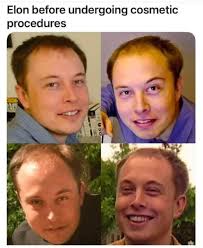 Not the supermodel he is now. Not to mention right wing role model more  importantly