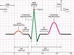 Image result for Electrocardiogram