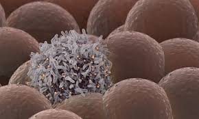 Cancer family relief fund is a charitable organization that encourages and facilitates grants to children whose parent or guardian is struggling with a diagnosis of cancer. Fda Grants Priority Review For Bayer S Liver Cancer Treatment