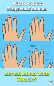 What Do Your Fingernail Moons Look Like The Answer Reveals Everything Health Fingernail Health Signs Health Signs
