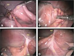 A Laparoscopic Approach For Removal Of Ovarian Remnant Tissue In 32 Dogs Bmc Veterinary Research Full Text