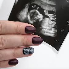 Jak Dbac O Paznokcie W Ciazy Ograniczenia W Pielegnacji Paznokci