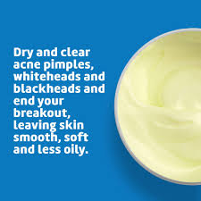 Maybe you would like to learn more about one of these? De La Cruz Sulfur Acne Treatment Maximum Strength And Water Washable To Clear Face And Body Acne For Adults And Teens 2 6 Oz Buy Online In Germany At Desertcart De Productid 1246392