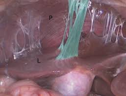 How do health care professionals diagnose a urinary tract infection? Chlamydia Infections Amboss