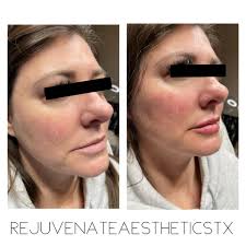 Rejuvenate Aesthetics