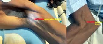 Image result for Collapsing Pulse