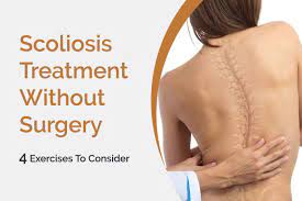 Scoliosis Treatment Without Surgery St Albert Physiotherapy