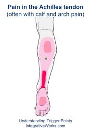 Some individuals may also experience a shooting pain when. Pin On Anatomy