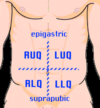 Image result for Shifting Dullness Test