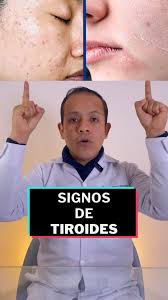🚨 ¡Síntomas de los problemas de #tiroides! 🚨, Los problemas de tiroides  pueden afectar muchas áreas de tu cuerpo, incluyendo tu cabello, piel,  cuello y rostro. Aquí te explico los síntomas más comunes ...